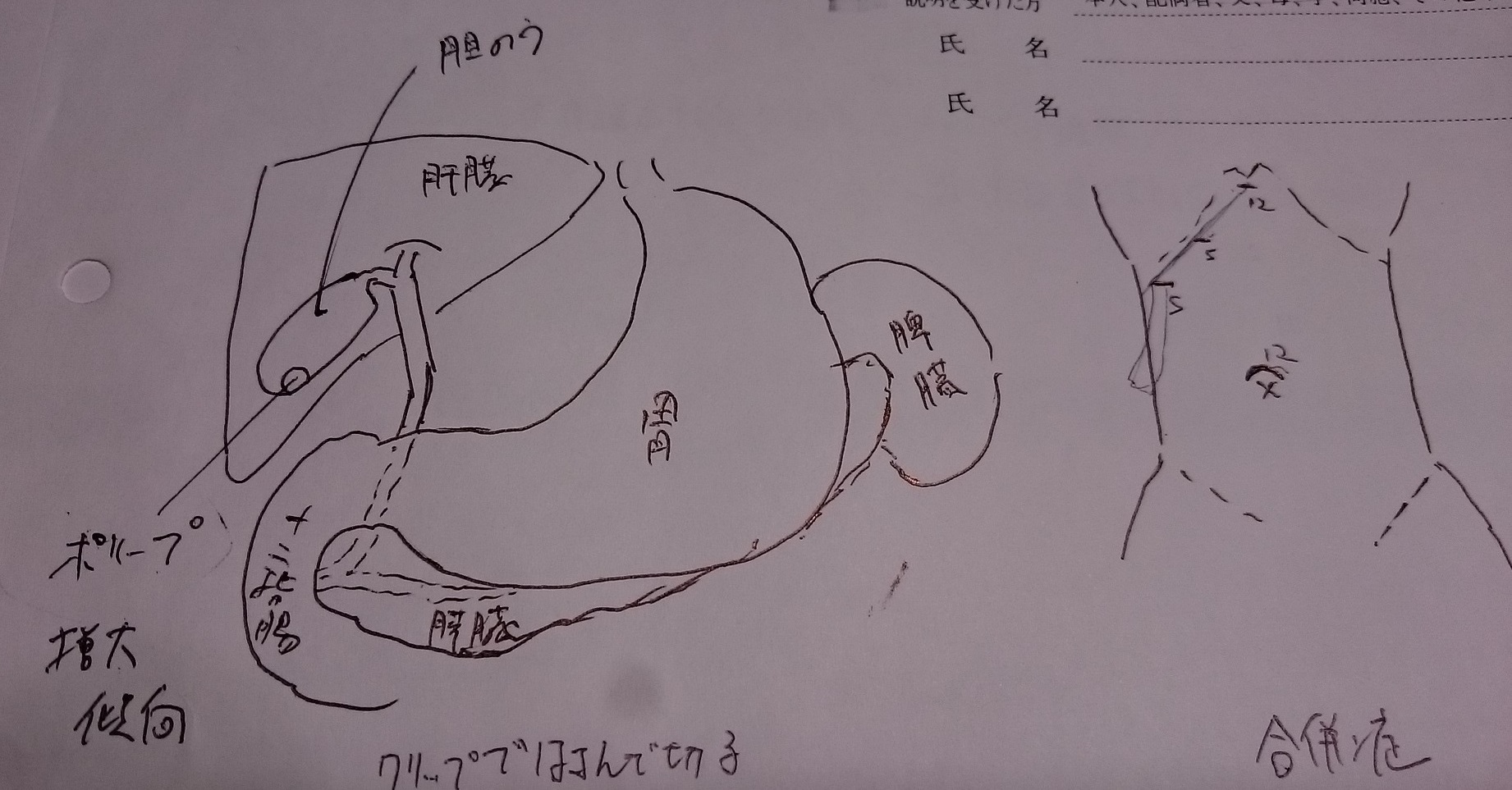 入院、思い出し日記　②_c0100865_22062283.jpg