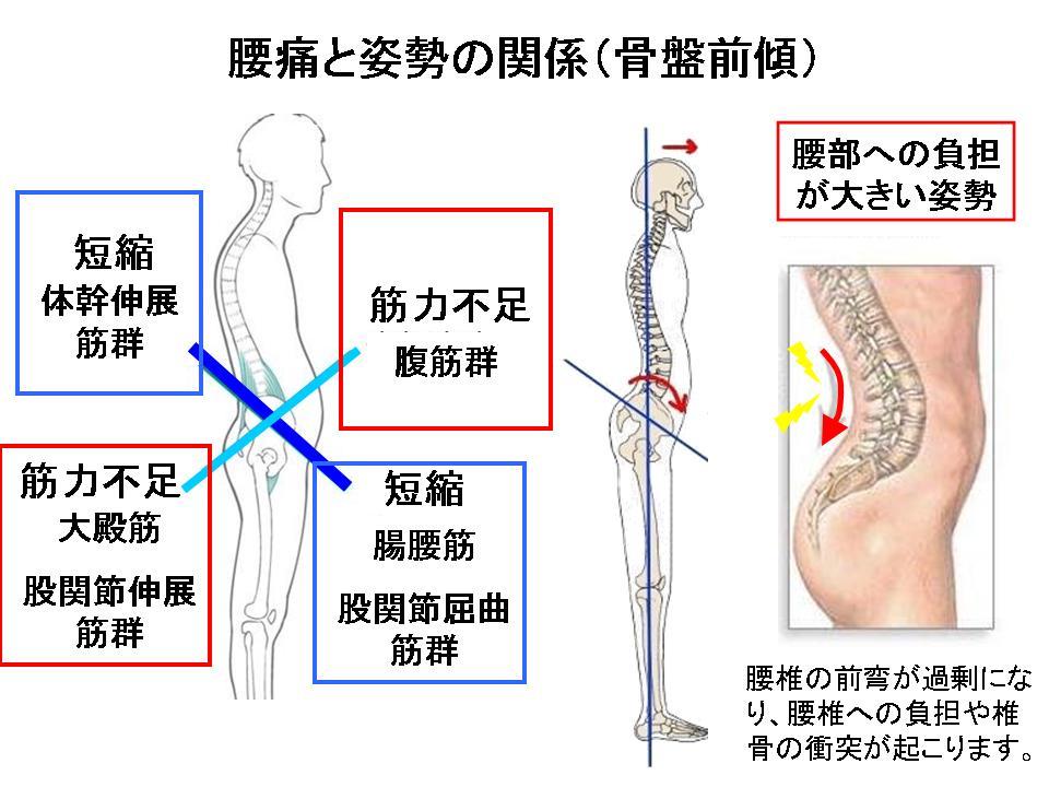 腰痛・下肢痛の診断と治療 ～骨盤と腰椎、股関節の関係を診る～』全2枚