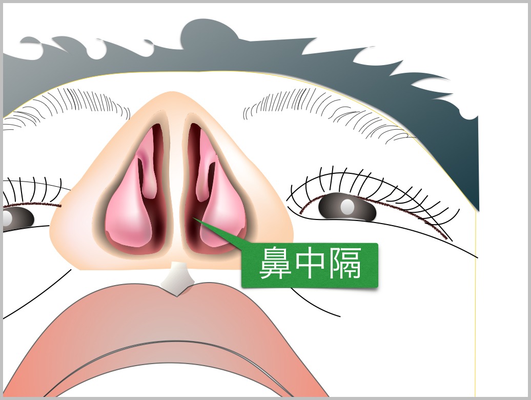 鼻中隔彎曲症_e0084756_2140469.jpg