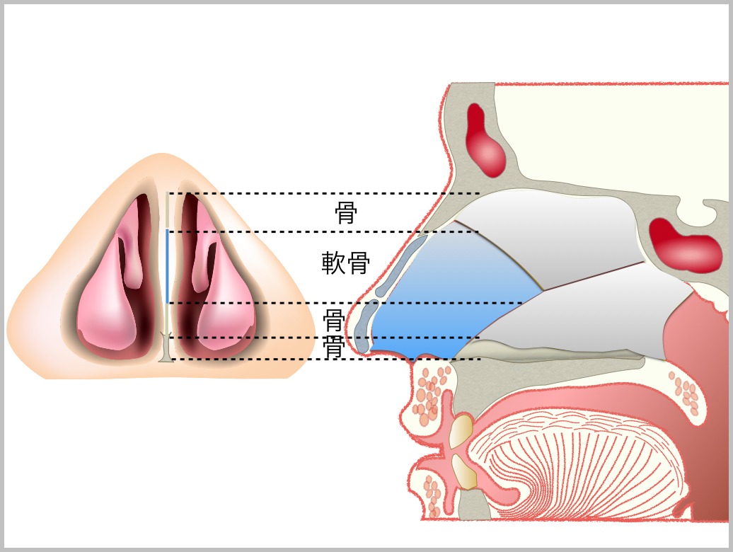 鼻中隔彎曲症_e0084756_21413929.jpg