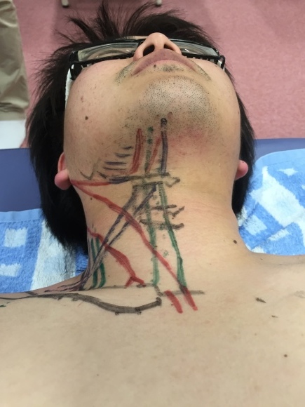 第19回運動器系体表解剖セミナー(東京会場) Bコース 2回目_b0329026_21291324.jpeg