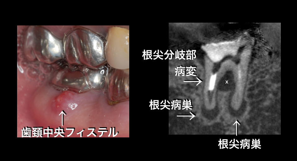e0004468_711694.png