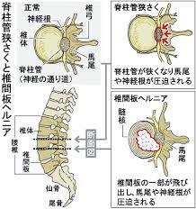 ６か月間のリハビリに入ろう_d0159325_1595265.jpg