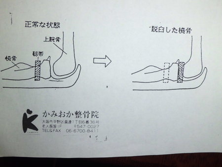 子供のひじ抜け　整復をするとすぐになおります。_e0096277_92254.jpg