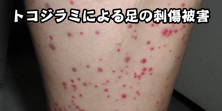 中国人の怖さとは？：爆買い支那人が南京大虐殺の復讐を南京虫で取った！？_a0348309_15332590.jpg