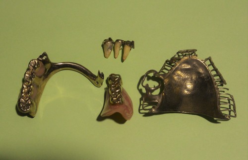 同級生から送られて来たお母様の遺品、高級補綴物_b0115553_22515743.jpg