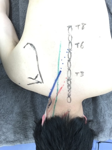 第19回運動器系体表解剖セミナー Bコース 東京会場 受講3回目_b0329026_20193226.jpeg