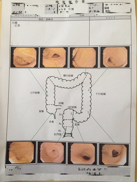 大腸内視鏡検査、カメラやった。事前の注意と当日。。_f0067528_17394348.jpeg