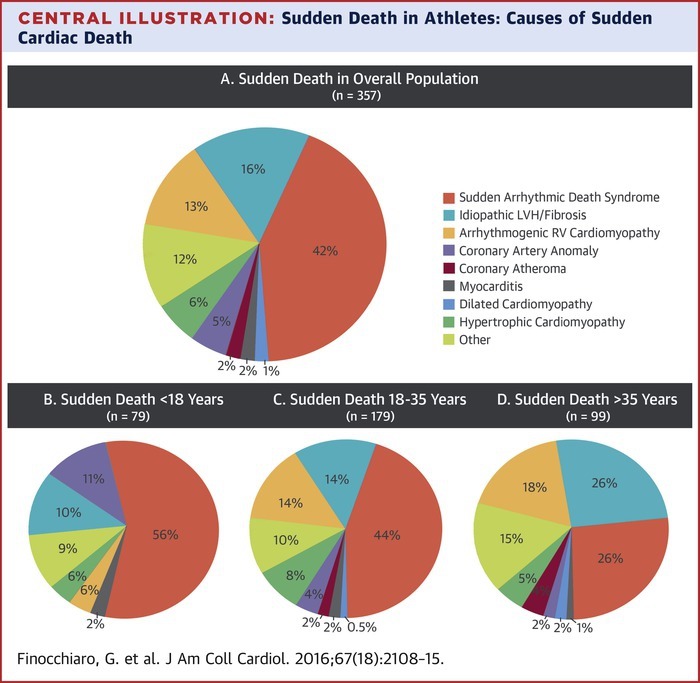 運動に関連した突然死の原因はなにか？：JACC誌 : 心房細動な日々