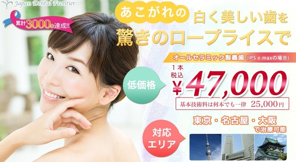 芸能人の歯は偽物や作り物が多く インプラントやオールセラミックできれいにする人も多い 芸能人の歯が白くて綺麗な理由 芸能人の歯は偽物や作り物が多く インプラントやオールセラミックできれいにする人も多い 芸能人の歯が白くて綺麗な理由