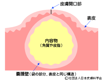 a0023397_17101509.gif