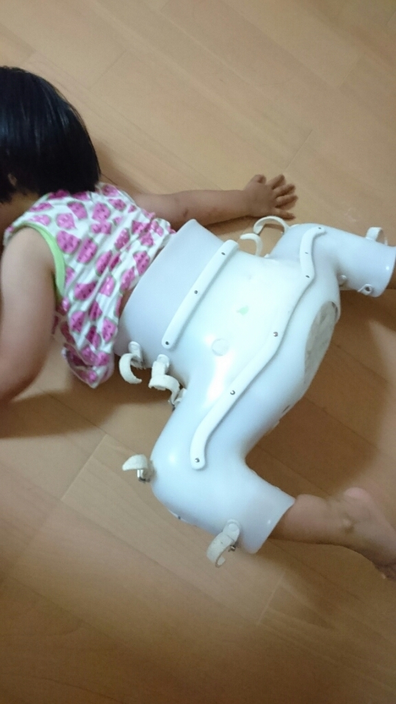 2歳ちゃんの先天性股関節脱臼の治療。第3段階リーメンデビュー_e0350000_18253974.jpg