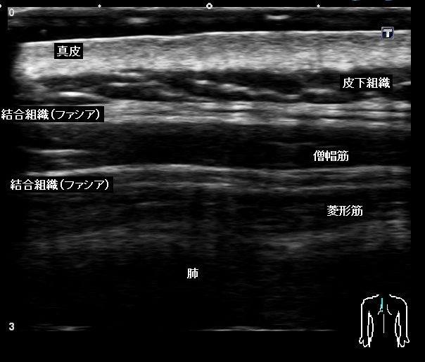 再び「筋膜リリース」の考察_b0052170_20224430.jpg