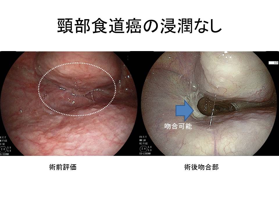 どこまで声をのこせるか_b0180148_19281063.jpg