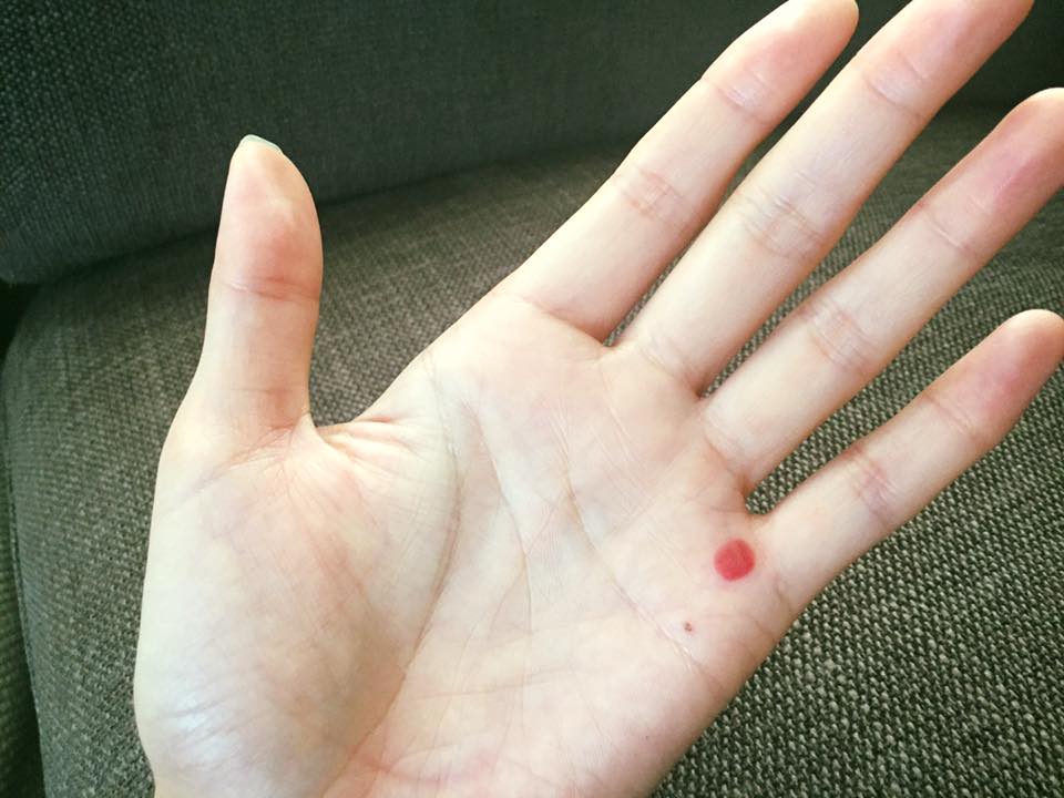 実は太鼓でパレードデビューだった(^-^)〜さんさ太鼓の勲章マメ♡_b0199244_7333232.jpg