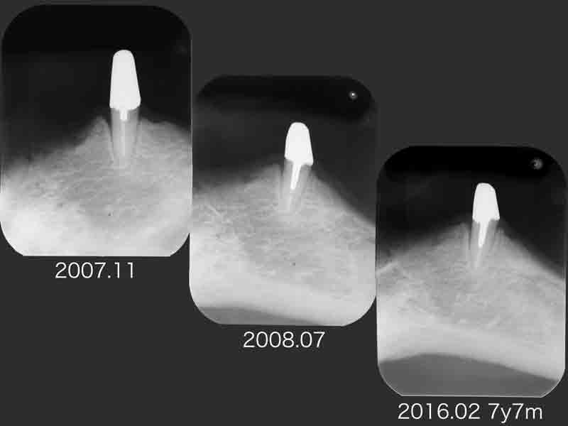 b0112648_10393254.jpg