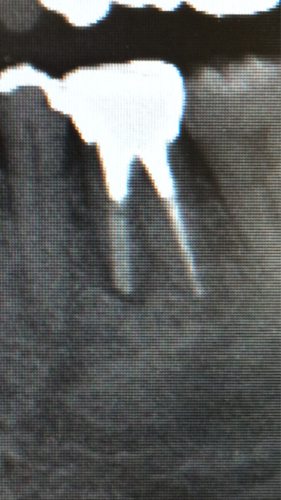 a0167308_19231431.jpg