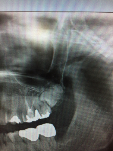 a0167308_19231597.jpg