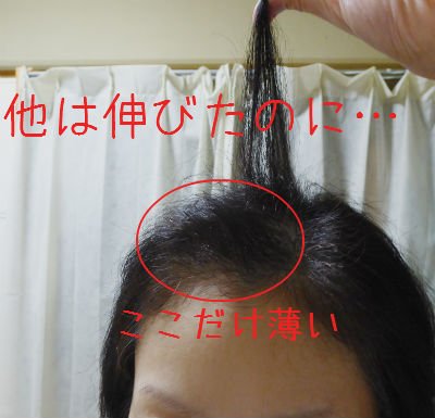 髪が伸びない 月の旅人 美月ココの徒然日記 髪が伸びない 月の旅人 美月ココの徒然日記