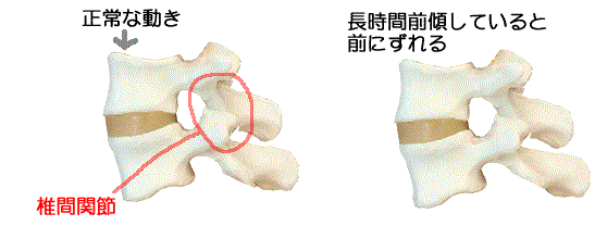 ムチウチ・・・整形では治らない_e0097212_1525894.gif