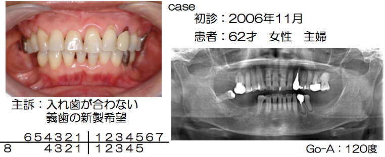 2016/12/20　院外勉強会に参加して参りました_b0112648_13261939.png