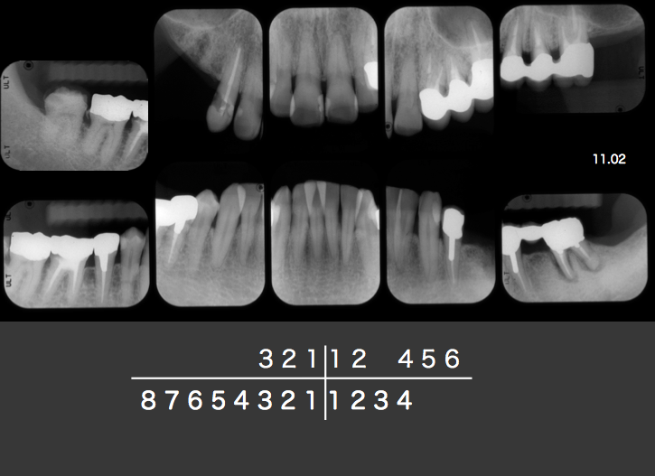 b0112648_17105607.png