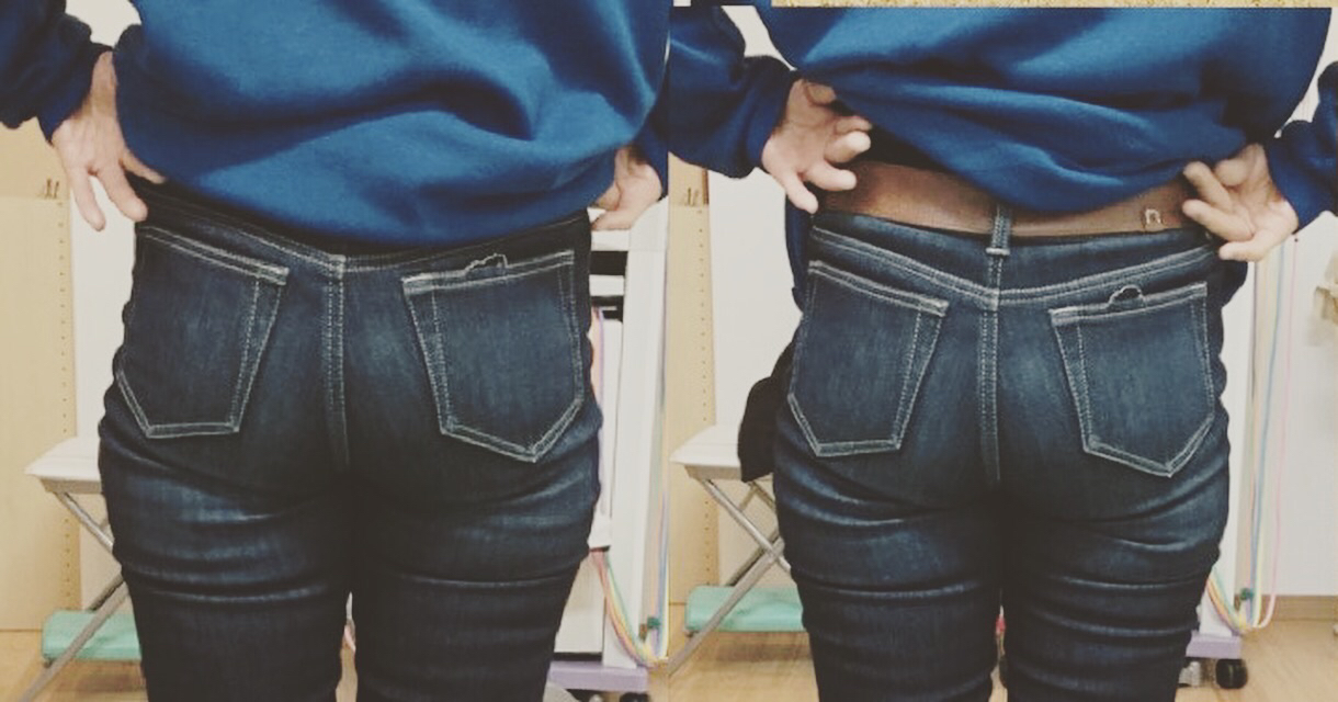 産後骨盤 美尻矯正 ビフォーアフター画像 つまだ通信ブログ