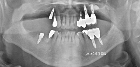 b0196070_11555110.jpg