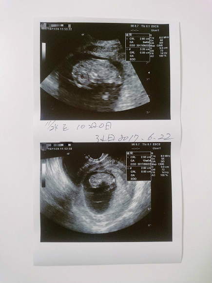 妊娠10週0日 妊婦健診 東京を食べ歩くネコ 妊娠10週0日 妊婦健診 東京を食べ歩くネコ
