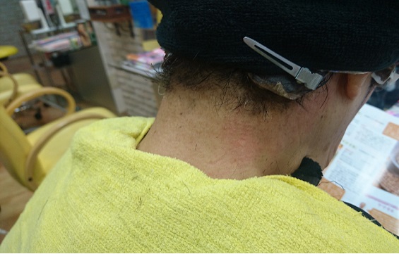 WAX脱毛!!_a0088668_1951597.jpg