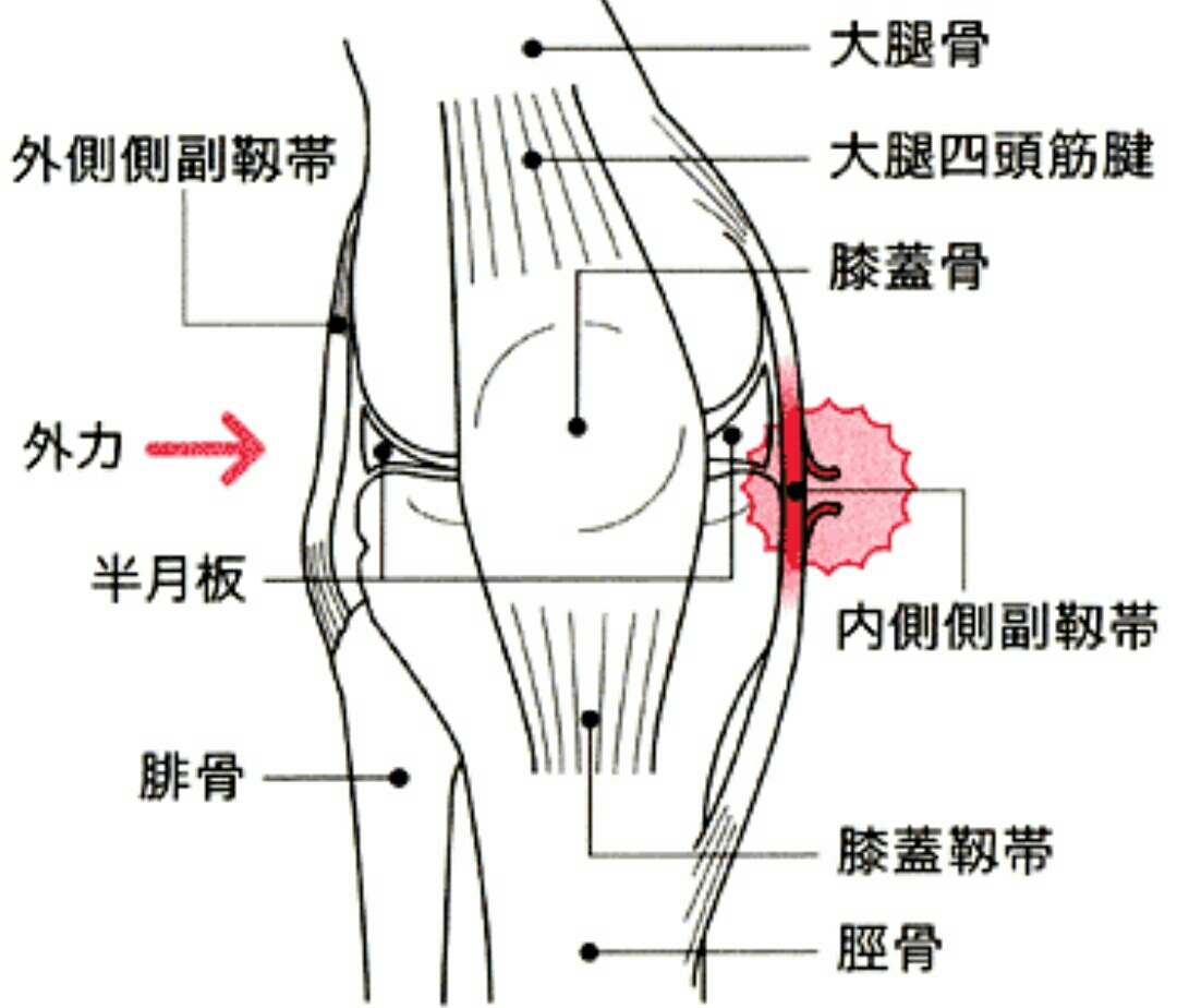 膝のケガ_e0326688_16202262.jpg