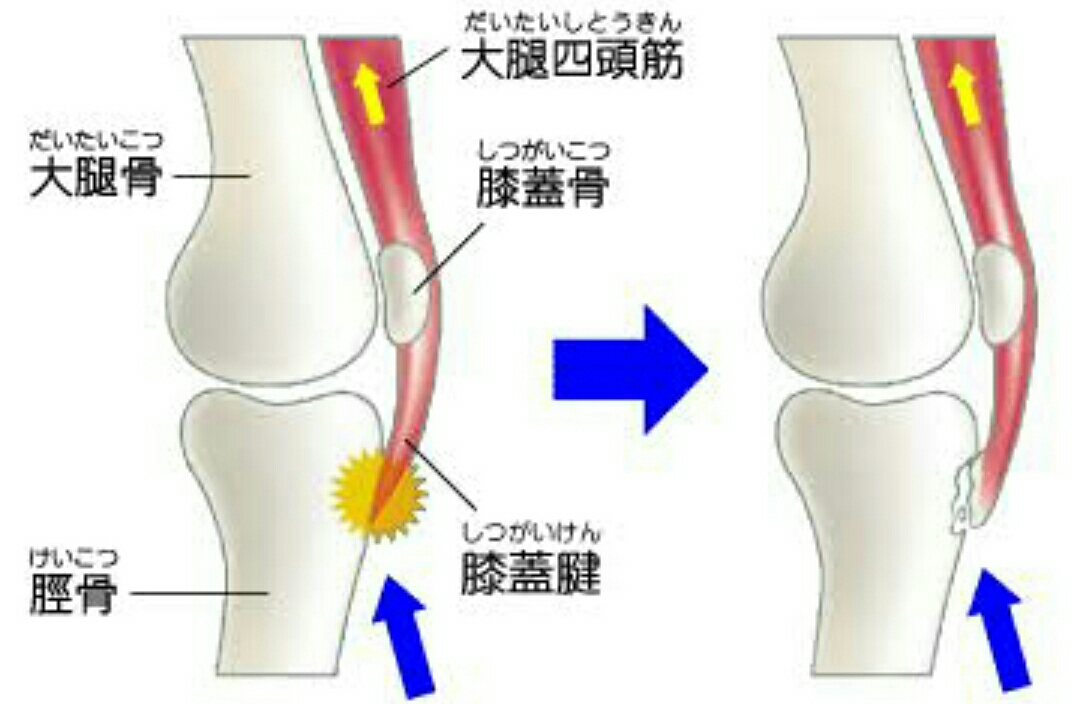 成長痛_e0326688_21472612.jpg