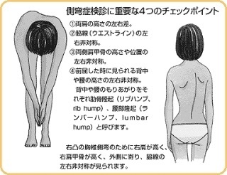 側弯症 Sports 憲法 政治 側弯症 Sports 憲法 政治
