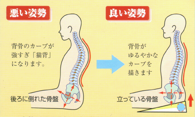 ギックリがきたぁ～！　4日目、、、、。_b0271789_08564587.gif