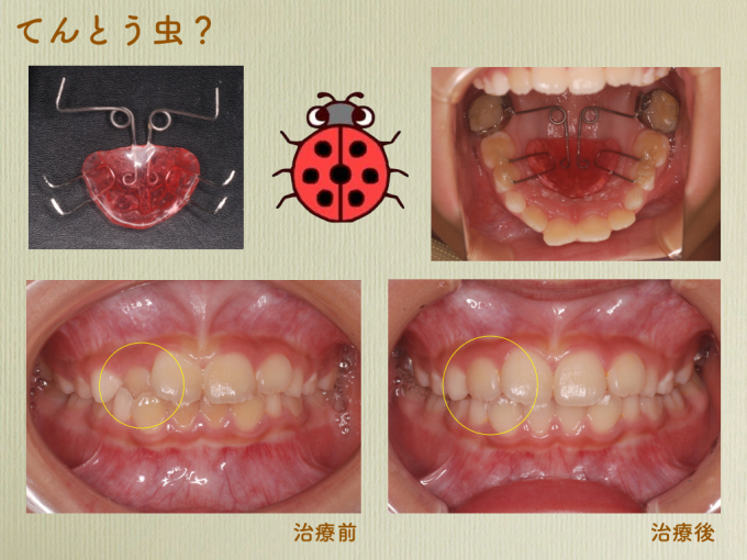 a0140882_20142041.jpeg