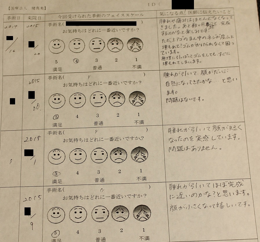 中顔面短縮術（LeFort一型骨切術）+下顎矢状分割術（SSRO） 術後約2年 _d0092965_0302514.jpg