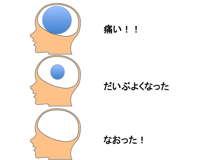 慢性痛の最新研究は脳科学_b0052170_18554556.jpg