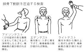 胸郭出口症候群 小胸筋編 ホロス加藤 札幌 カイロ トリガーポイント
