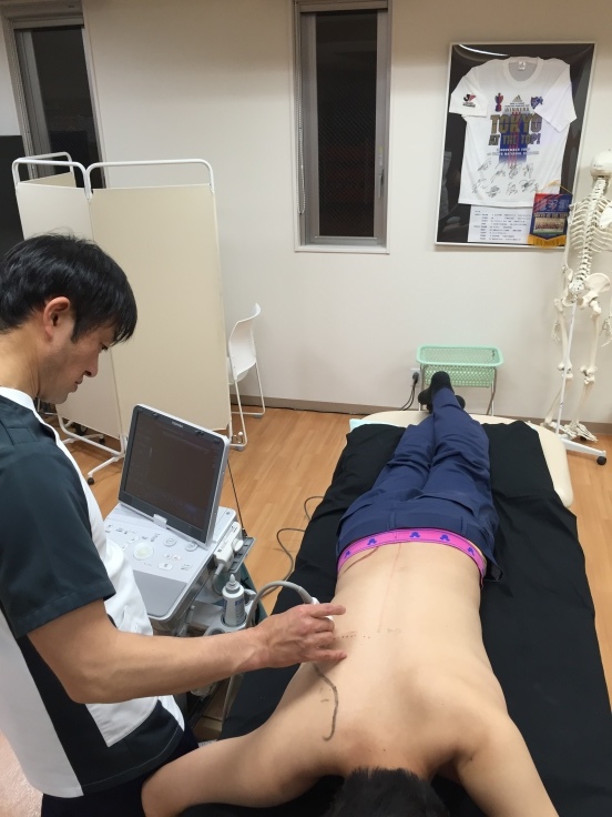 第119回TOC体表解剖勉強会 広背筋、大円筋_b0329026_19474310.jpeg