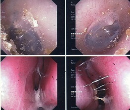 ５９回受診、抗菌薬使用なし。_a0082724_21240344.jpg