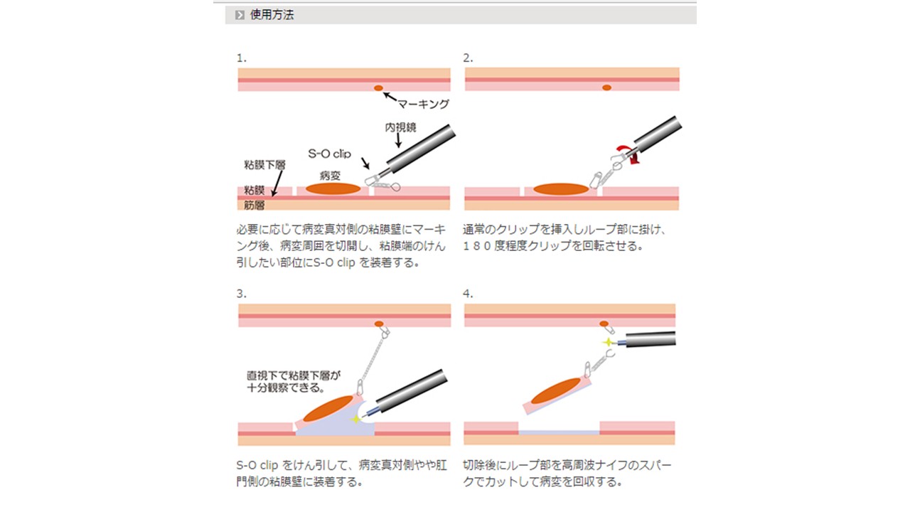 Ｓ－Ｏ　クリップ_b0180148_12581846.jpg