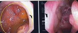 大量膿性鼻汁、出血も多量でした。_a0082724_15440178.jpg