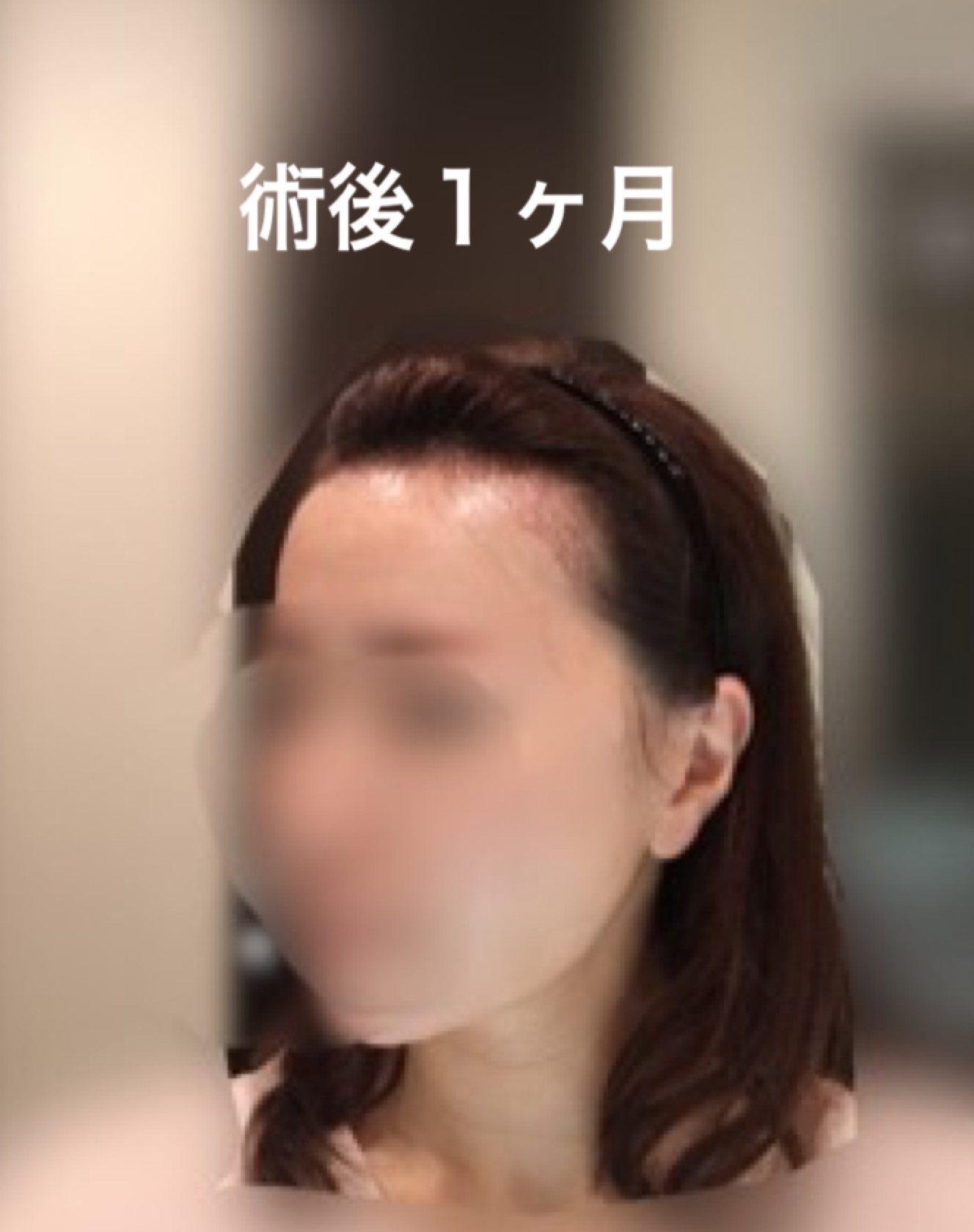 術後５ヶ月までのまとめ_d0367324_12195067.png