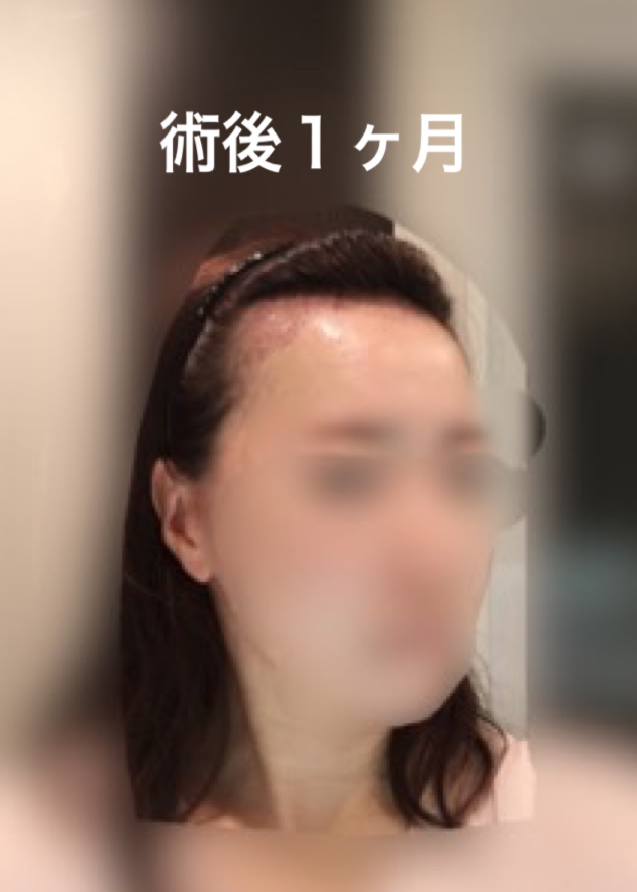 術後５ヶ月までのまとめ_d0367324_12201004.png