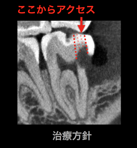 e0004468_10393854.png