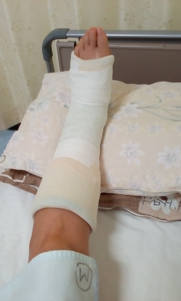 腓骨筋腱脱臼 入院3日目 Re Start 腓骨筋腱脱臼 入院3日目 Re Start