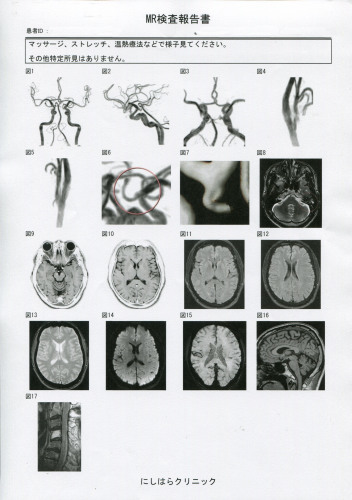  『なぜ、お誕生日に”MRI\"？の理由、その3』_f0068334_10580283.jpg