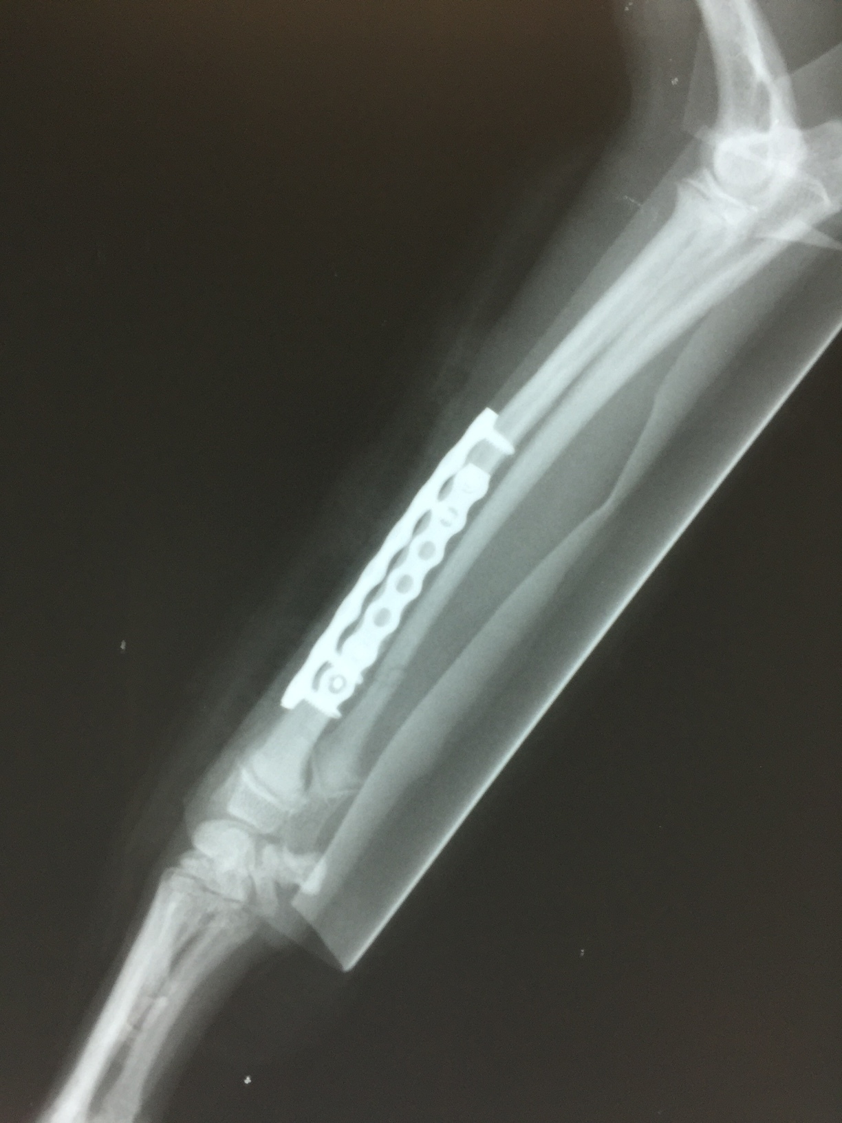 超小型犬 ALPSチタンプレートによる橈尺骨骨折手術_b0350282_13333121.jpg