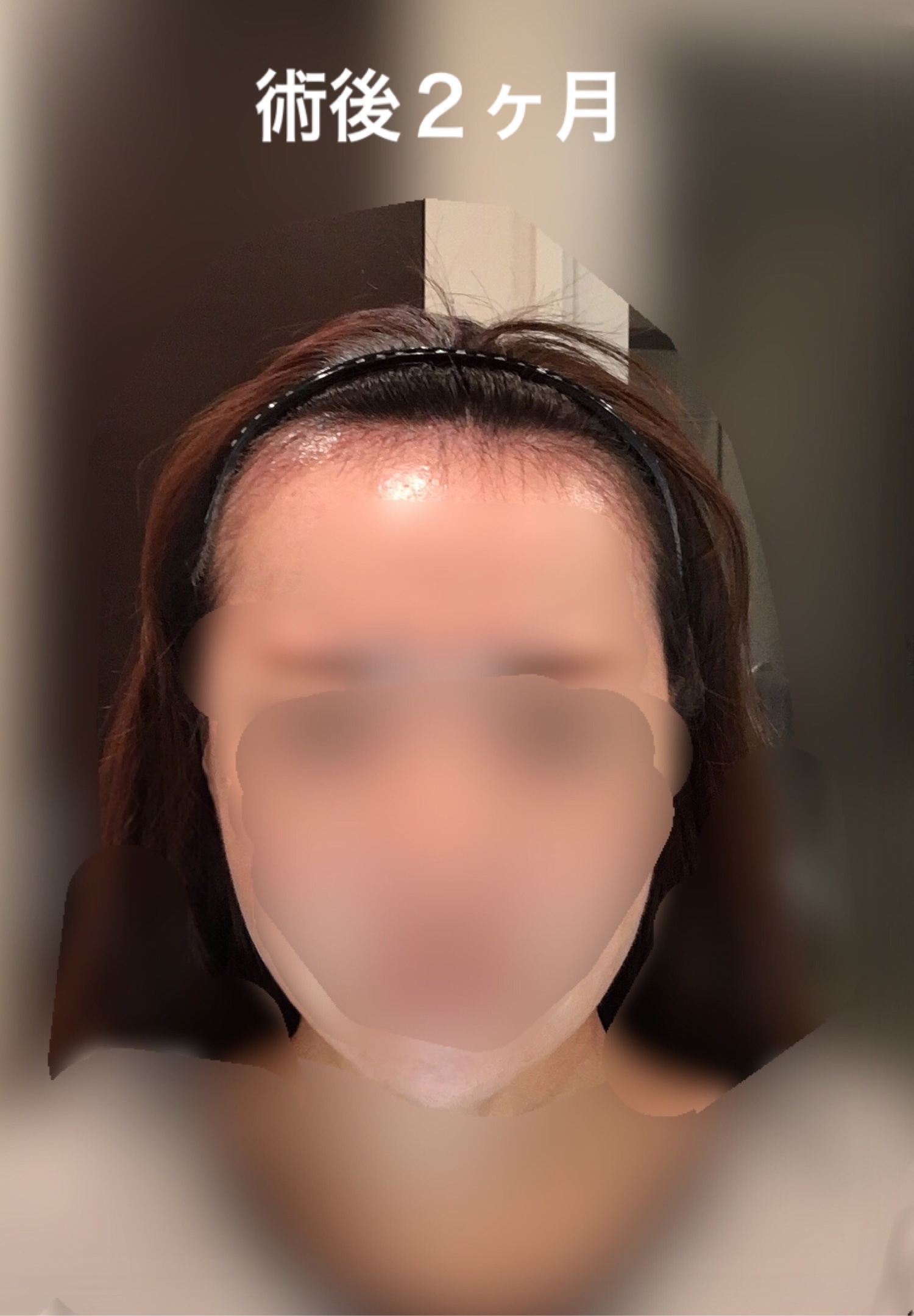 術後５ヶ月までのまとめ_d0367324_10454224.jpeg