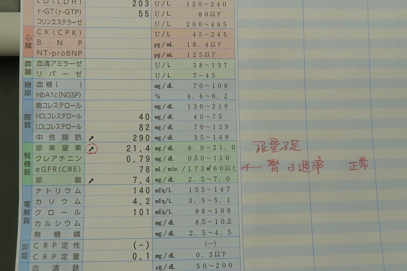 関節とペグマタイト_f0076731_19250348.jpg